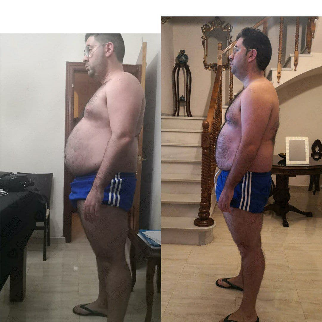 Caso de éxito de Carlos