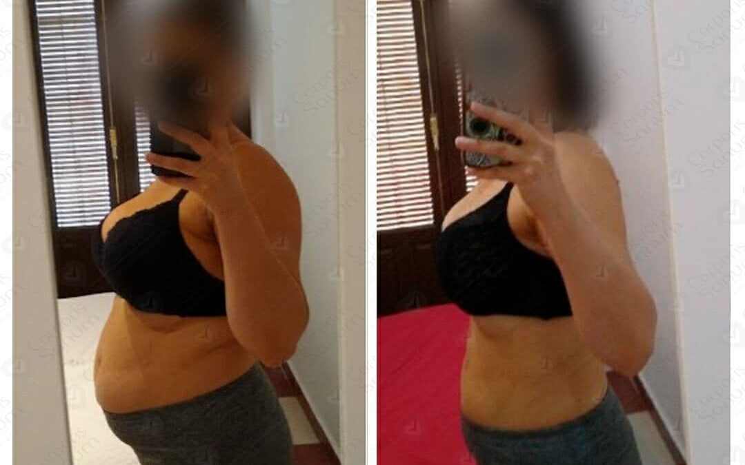 Caso de éxito de Tamara