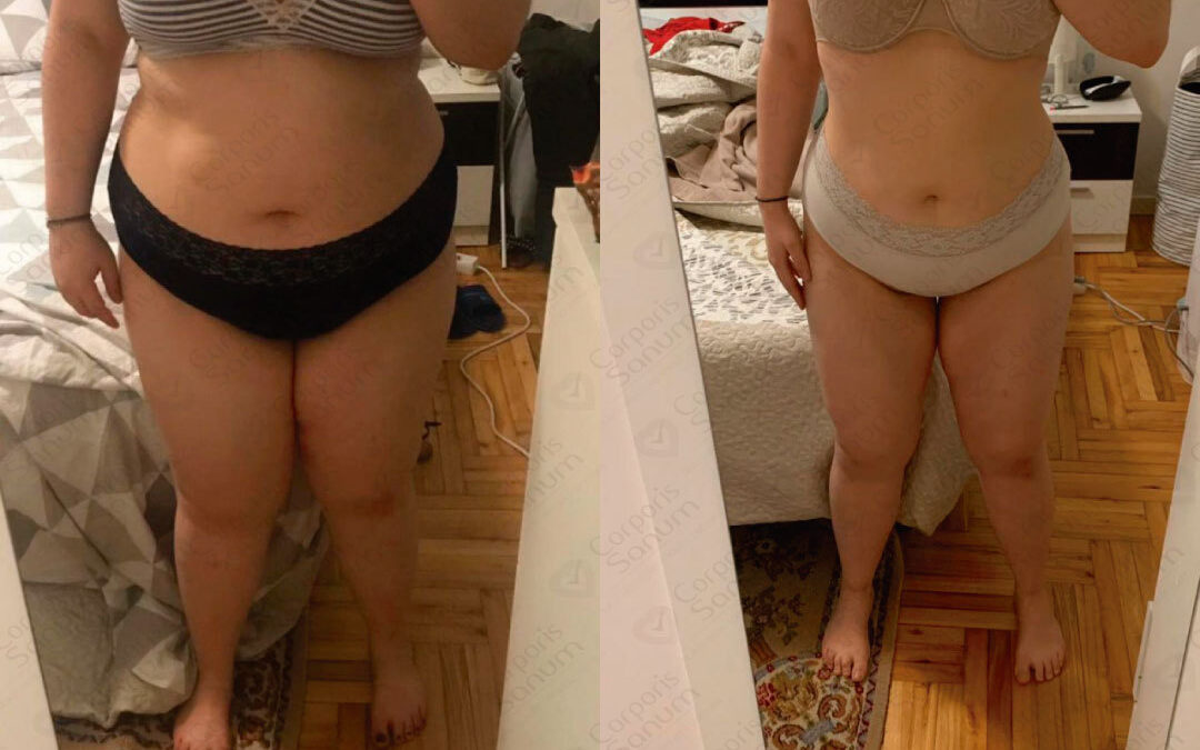 Caso de éxito de Juana