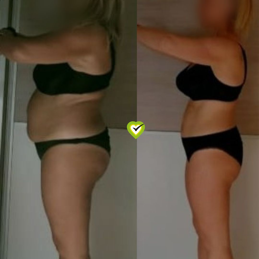 caso de éxito de mila